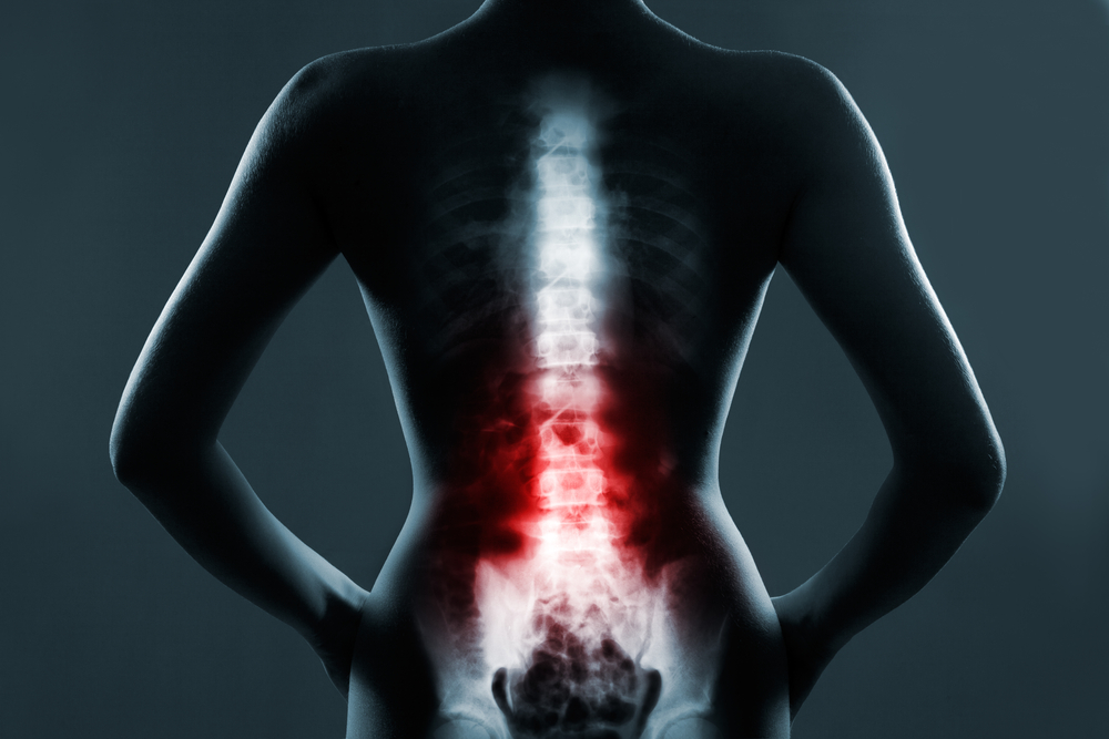 Image result for Fibromyalgia Pain May Be Linked to Spinal Cord Dysfunction, Researchers Say