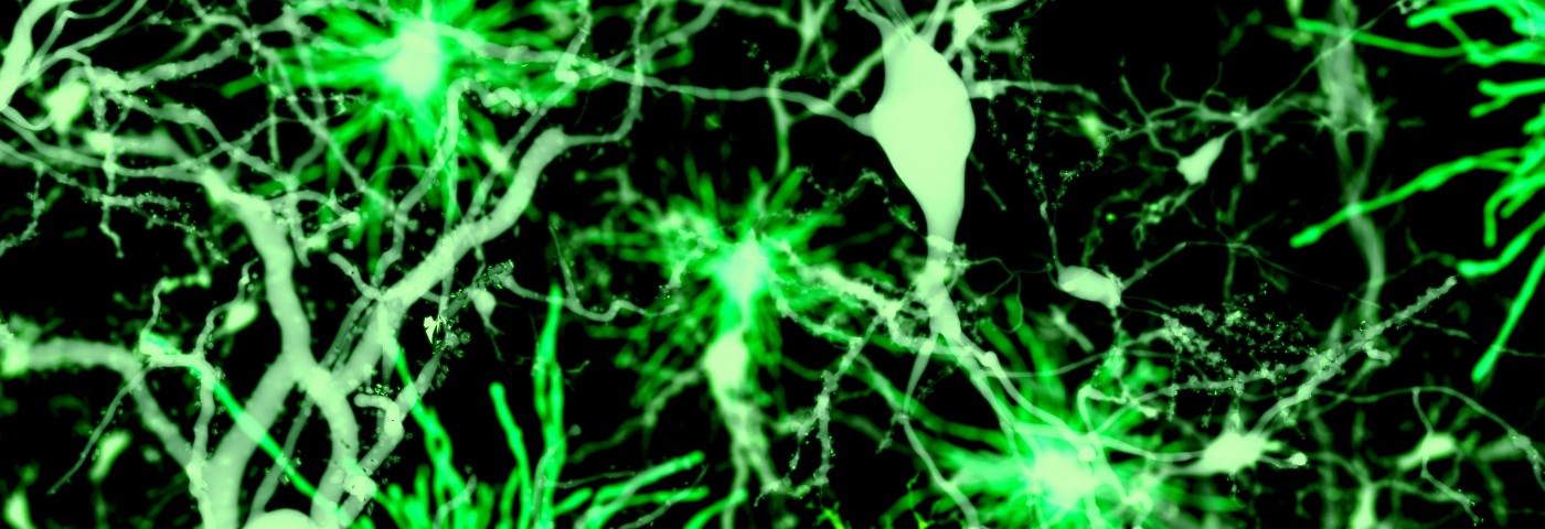 Understanding Brain Immune Interactions in Fibromyalgia May Lead to Better Treatments