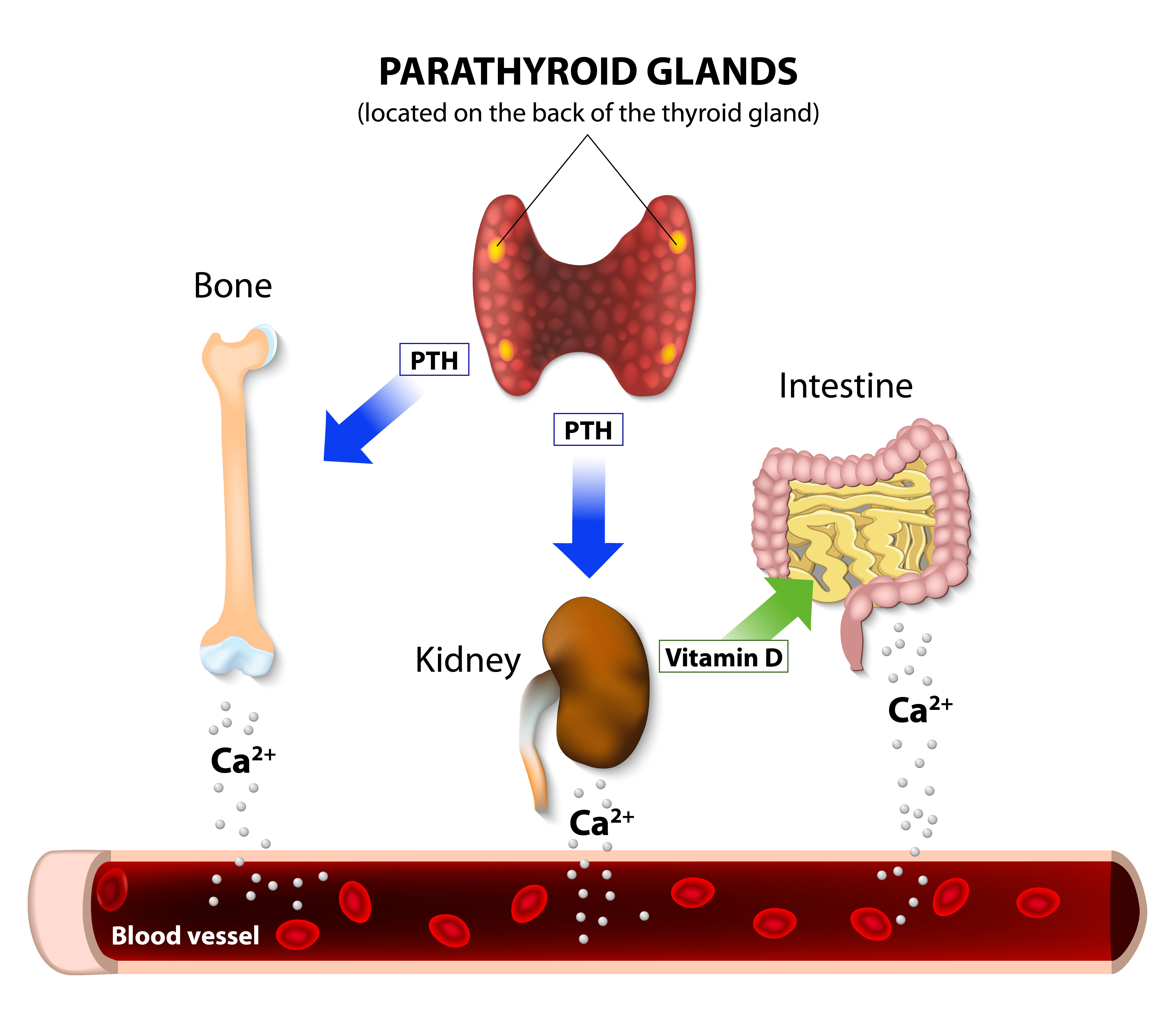 Hyperactive Parathyroid May Trouble Women with Fibromyalgia, Study ...