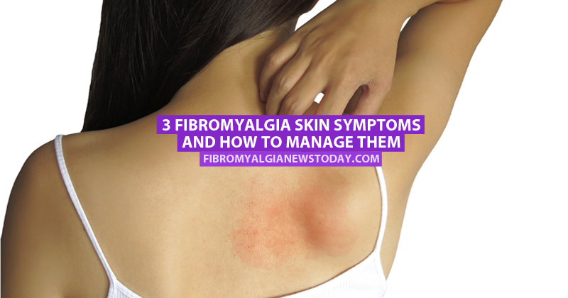 Skin Symptoms How to Manage Them - Fibromyalgia News Today