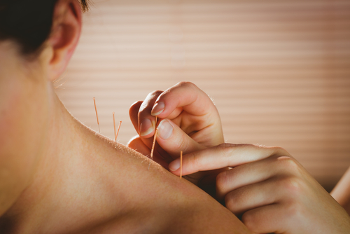 acupuncture, fibromyalgia-related pain